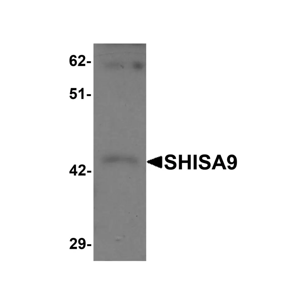 ProSci 6057 SHISA9 Antibody, ProSci, 0.1 mg/Unit Primary Image