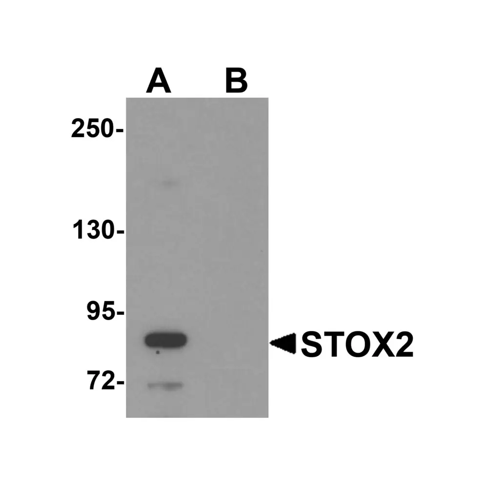 ProSci 6061 STOX2 Antibody, ProSci, 0.1 mg/Unit Primary Image