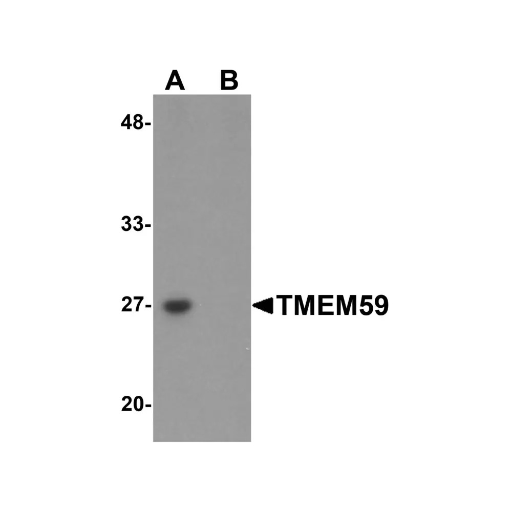 ProSci 6063_S TMEM59 Antibody, ProSci, 0.02 mg/Unit Primary Image
