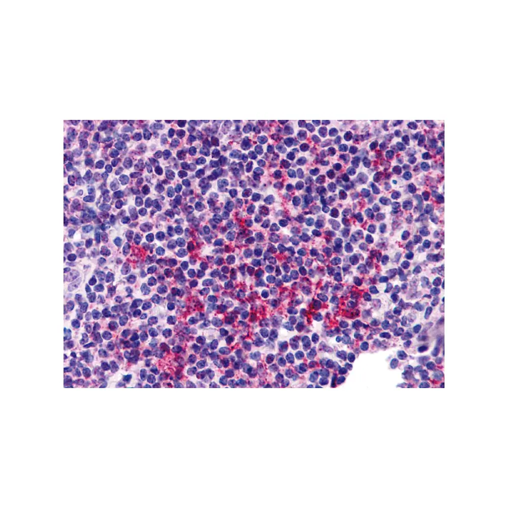 ProSci 6067_S ZNF687 Antibody, ProSci, 0.02 mg/Unit Primary Image