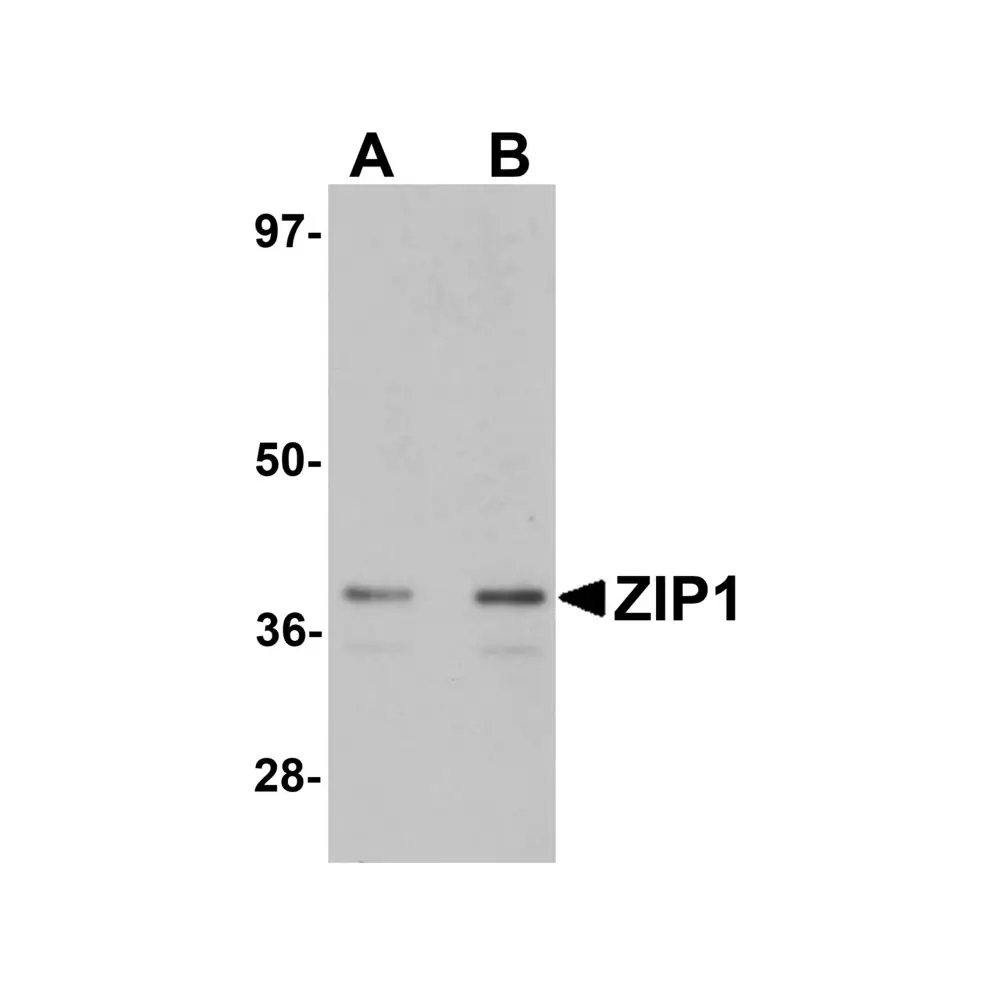 ProSci 6081 ZIP1 Antibody, ProSci, 0.1 mg/Unit Primary Image