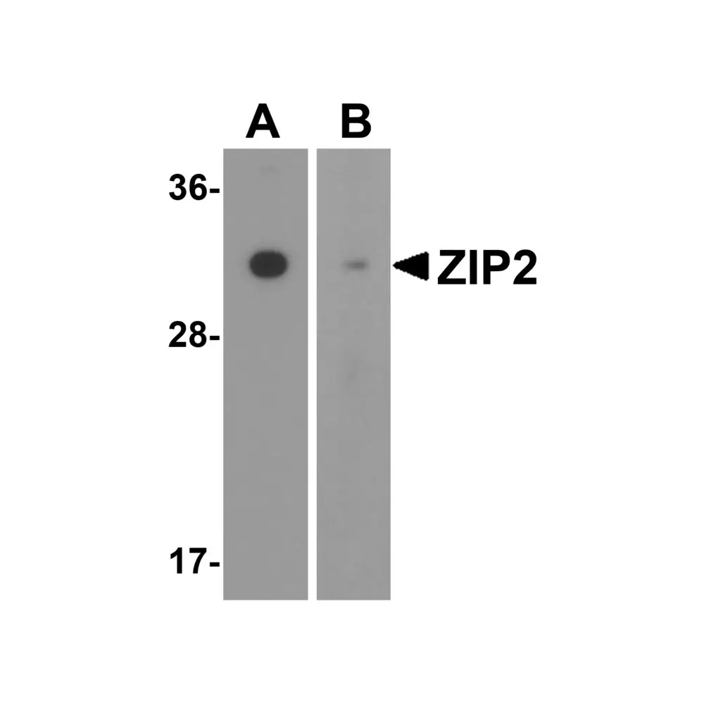 ProSci 6083 ZIP2 Antibody, ProSci, 0.1 mg/Unit Primary Image