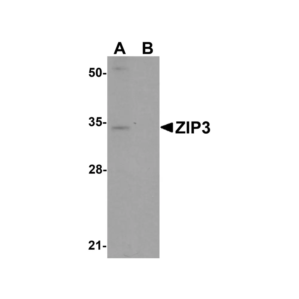 ProSci 6085 ZIP3 Antibody, ProSci, 0.1 mg/Unit Primary Image