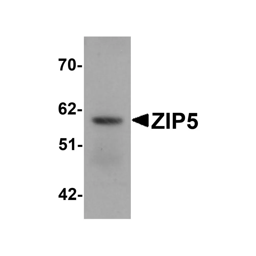 ProSci 6089 ZIP5 Antibody, ProSci, 0.1 mg/Unit Primary Image