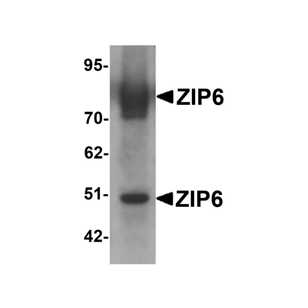 ProSci 6091 ZIP6 Antibody, ProSci, 0.1 mg/Unit Primary Image