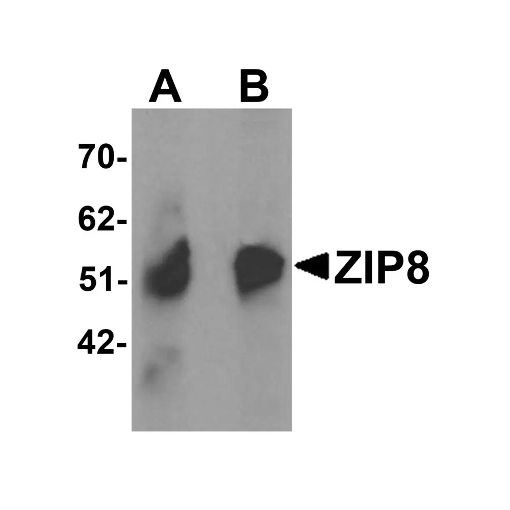 ProSci 6095 ZIP8 Antibody, ProSci, 0.1 mg/Unit Primary Image