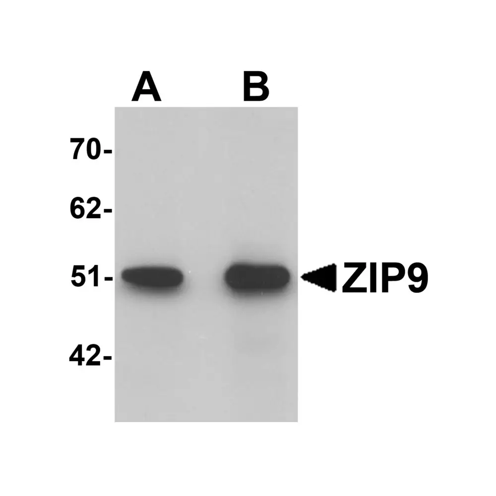 ProSci 6097 ZIP9 Antibody, ProSci, 0.1 mg/Unit Primary Image