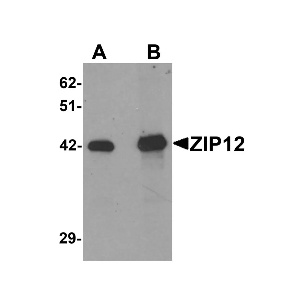 ProSci 6101 ZIP12 Antibody, ProSci, 0.1 mg/Unit Primary Image