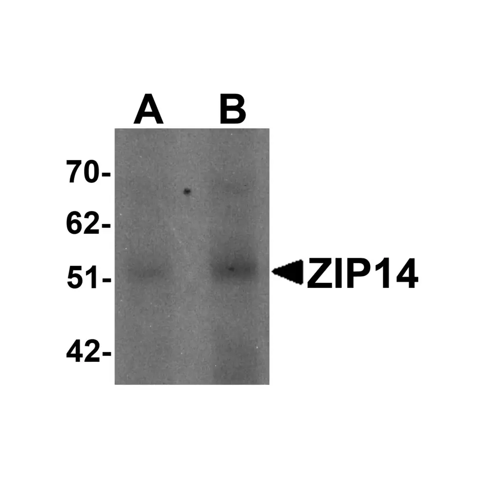 ProSci 6105 ZIP14 Antibody, ProSci, 0.1 mg/Unit Primary Image