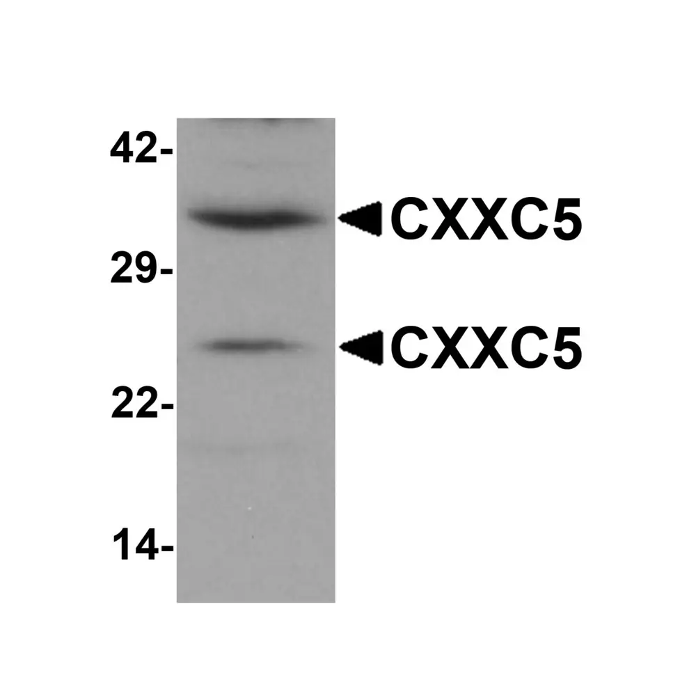 ProSci 6111_S CXXC5 Antibody, ProSci, 0.02 mg/Unit Primary Image