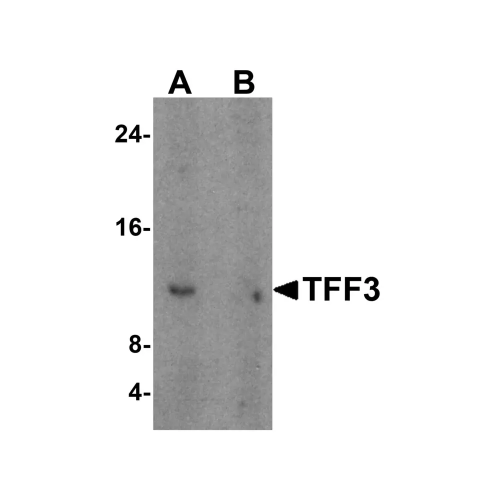 ProSci 6113 TFF3 Antibody, ProSci, 0.1 mg/Unit Primary Image