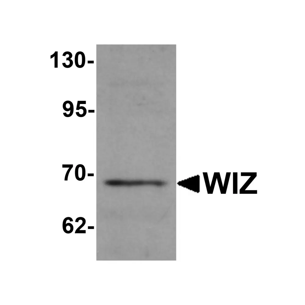 ProSci 6117_S WIZ Antibody, ProSci, 0.02 mg/Unit Primary Image