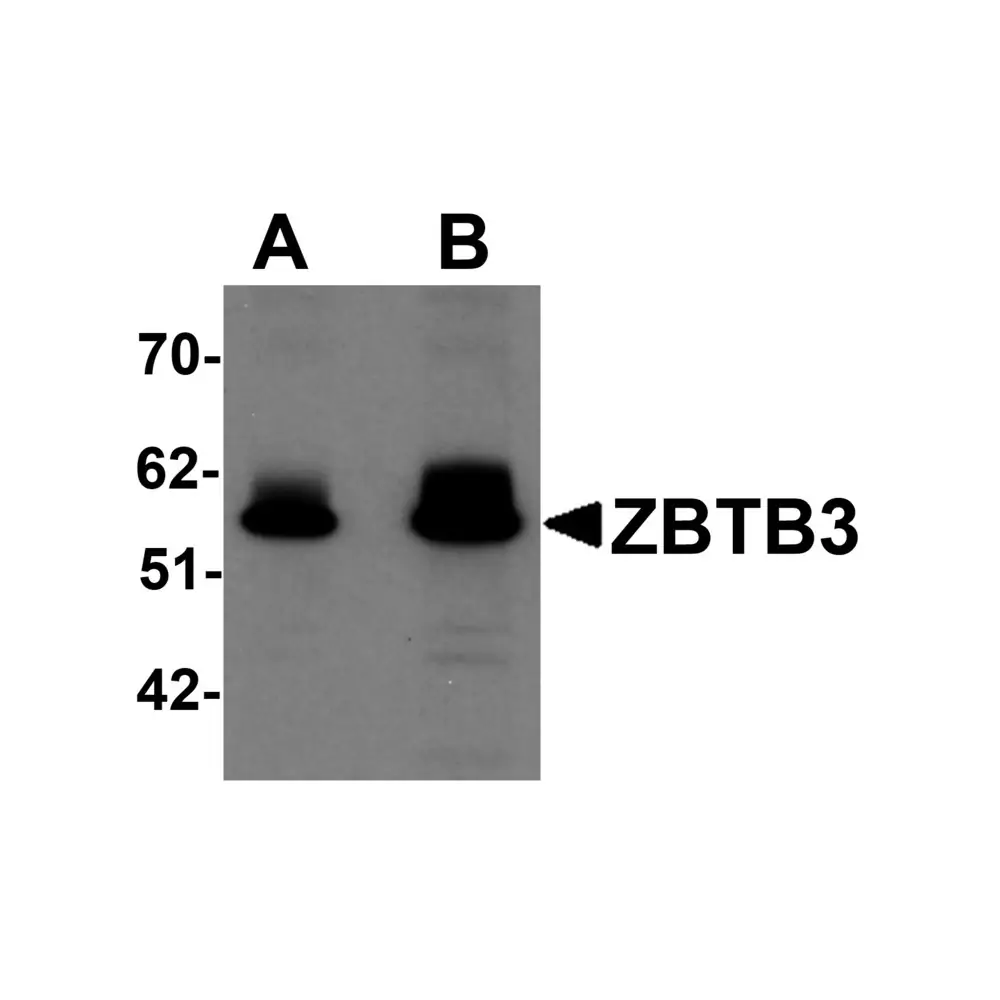 ProSci 6119 ZBTB3 Antibody, ProSci, 0.1 mg/Unit Primary Image