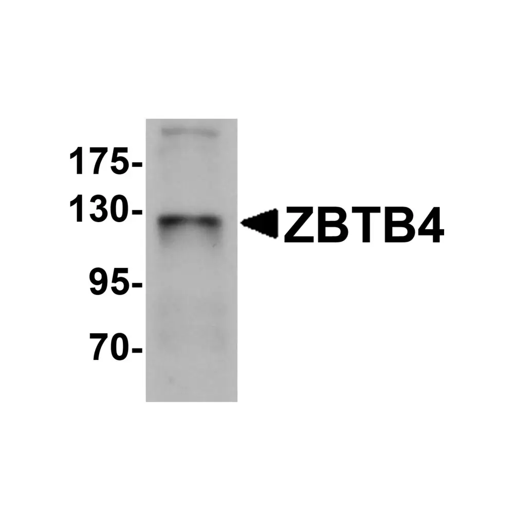 ProSci 6121_S ZBTB4 Antibody, ProSci, 0.02 mg/Unit Primary Image