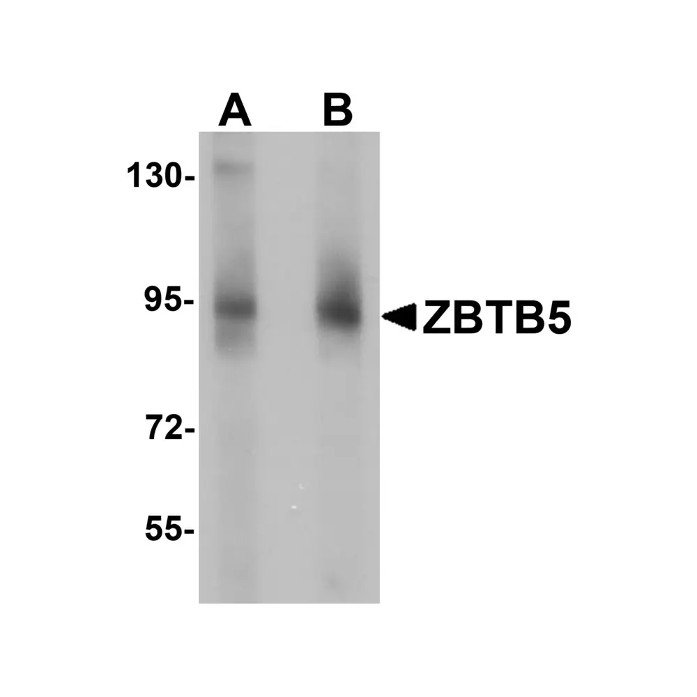ProSci 6123 ZBTB5 Antibody, ProSci, 0.1 mg/Unit Primary Image