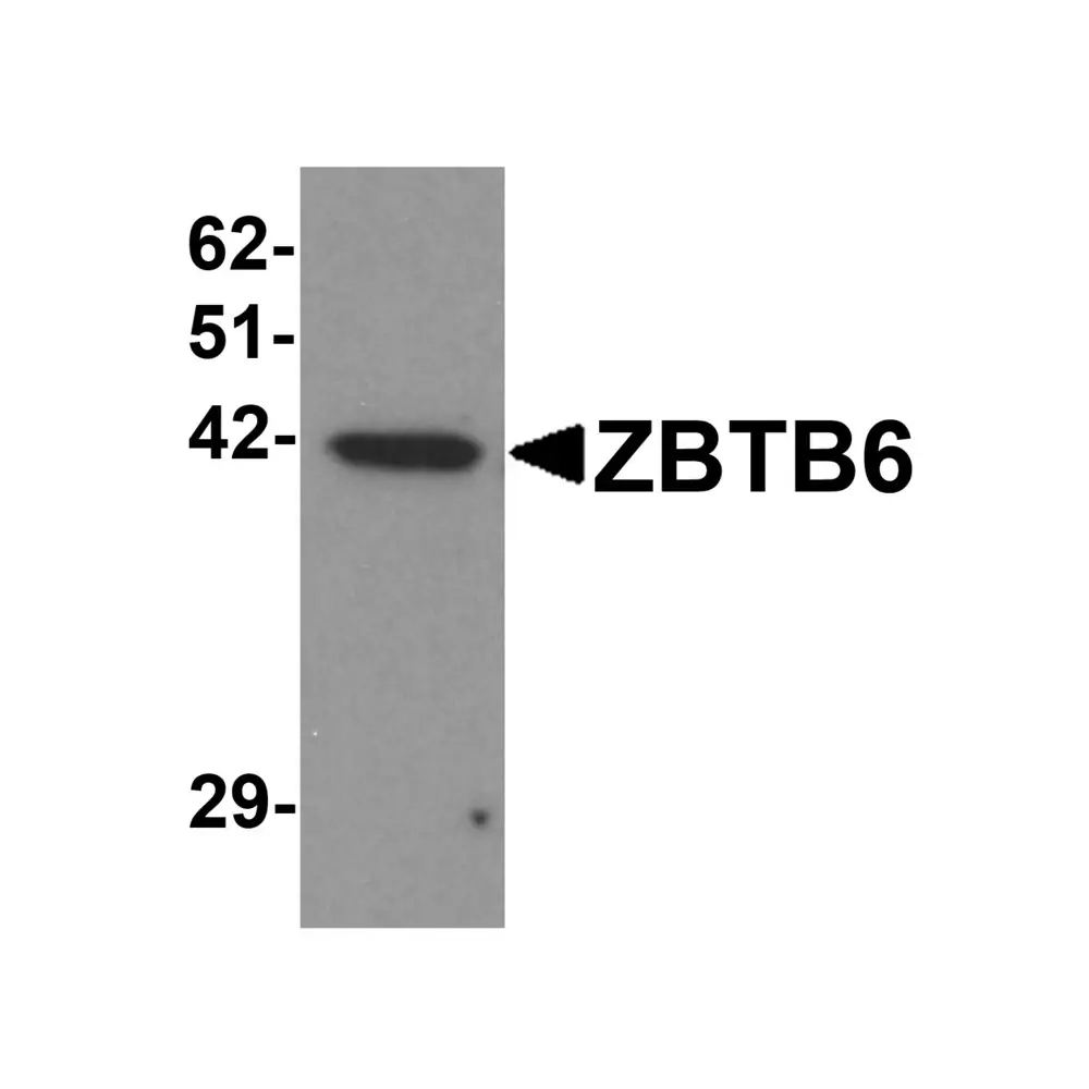 ProSci 6125 ZBTB6 Antibody, ProSci, 0.1 mg/Unit Primary Image