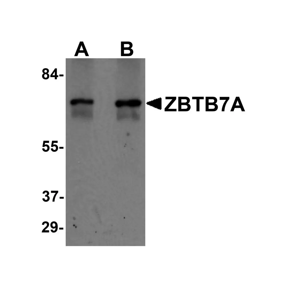 ProSci 6127 ZBTB7A Antibody, ProSci, 0.1 mg/Unit Primary Image