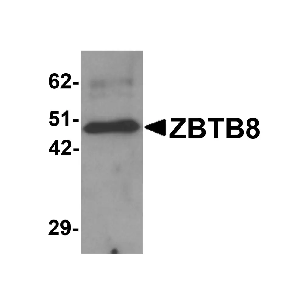 ProSci 6129 ZBTB8 Antibody, ProSci, 0.1 mg/Unit Primary Image