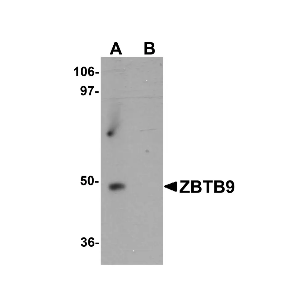 ProSci 6131 ZBTB9 Antibody, ProSci, 0.1 mg/Unit Primary Image