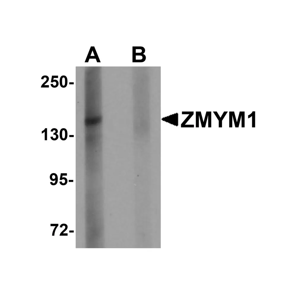 ProSci 6133 ZMYM1 Antibody, ProSci, 0.1 mg/Unit Primary Image