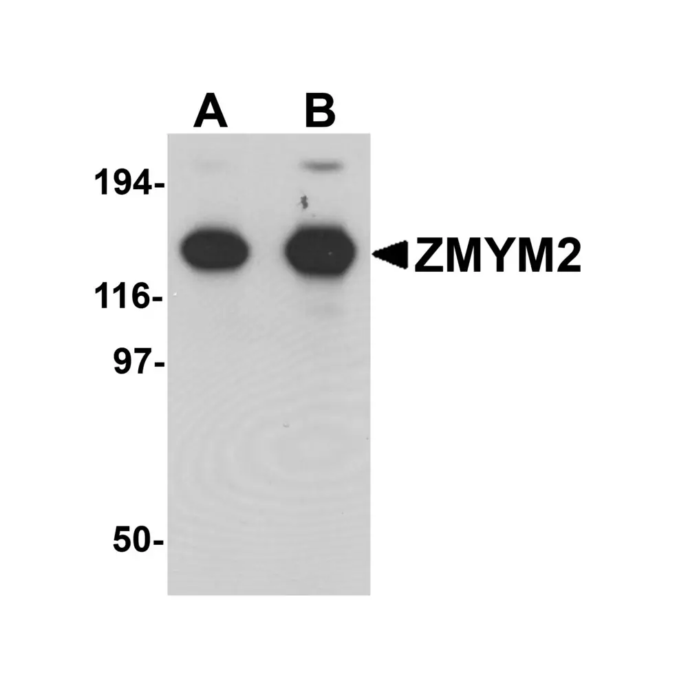 ProSci 6135_S ZMYM2 Antibody, ProSci, 0.02 mg/Unit Primary Image