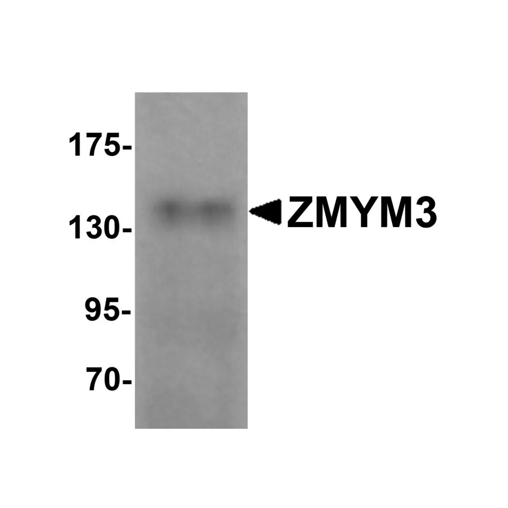 ProSci 6137 ZMYM3 Antibody, ProSci, 0.1 mg/Unit Primary Image