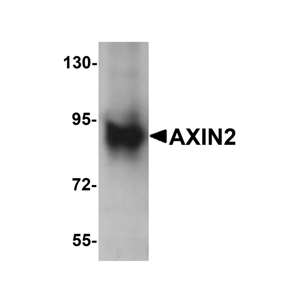 ProSci 6163 AXIN2 Antibody, ProSci, 0.1 mg/Unit Primary Image