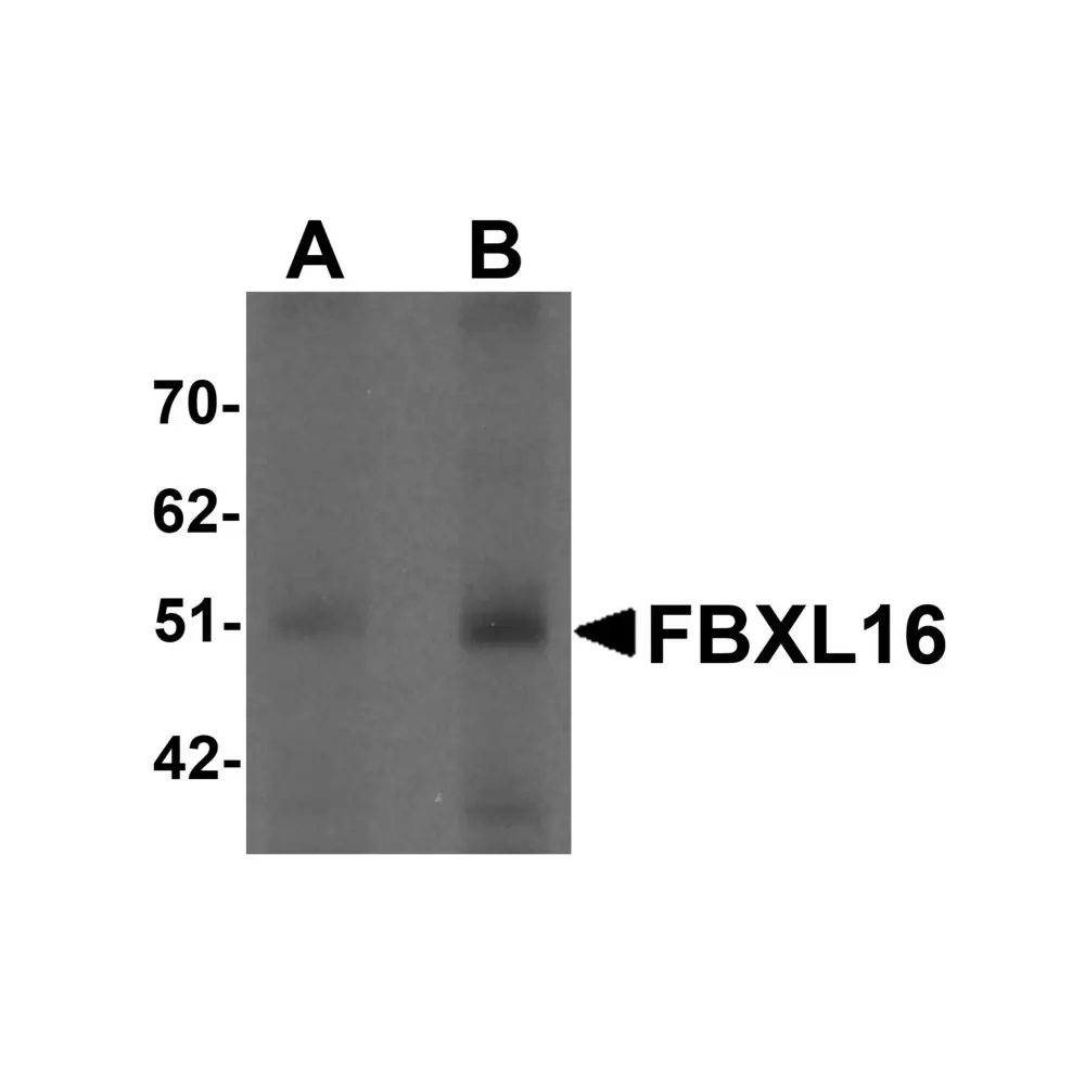 ProSci 6165 FBXL16 Antibody, ProSci, 0.1 mg/Unit Primary Image
