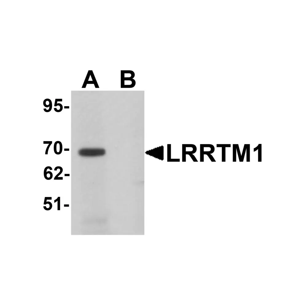 ProSci 6167_S LRRTM1 Antibody, ProSci, 0.02 mg/Unit Primary Image