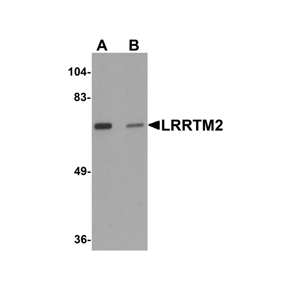 ProSci 6169_S LRRTM2 Antibody, ProSci, 0.02 mg/Unit Primary Image
