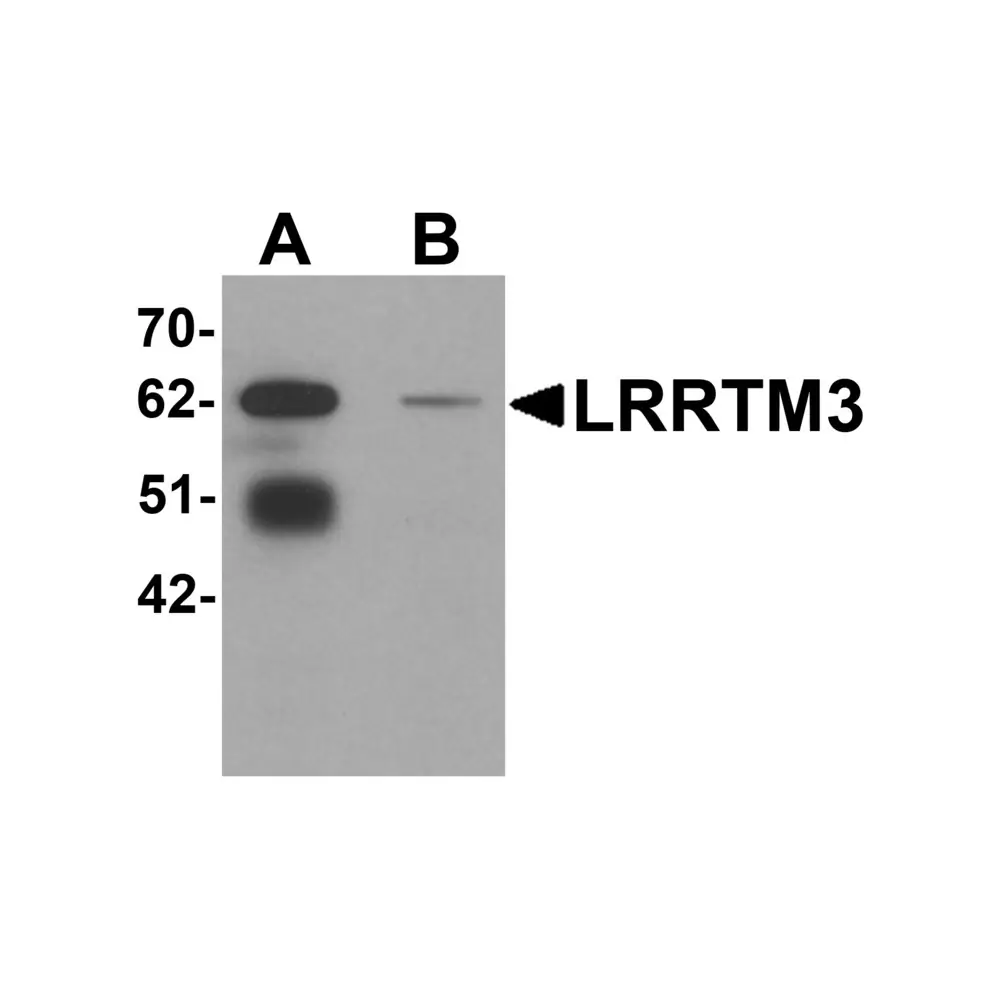 ProSci 6171_S LRRTM3 Antibody, ProSci, 0.02 mg/Unit Primary Image