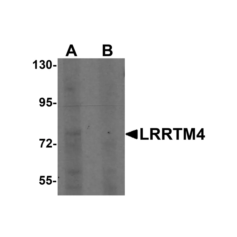 ProSci 6173 LRRTM4 Antibody, ProSci, 0.1 mg/Unit Primary Image