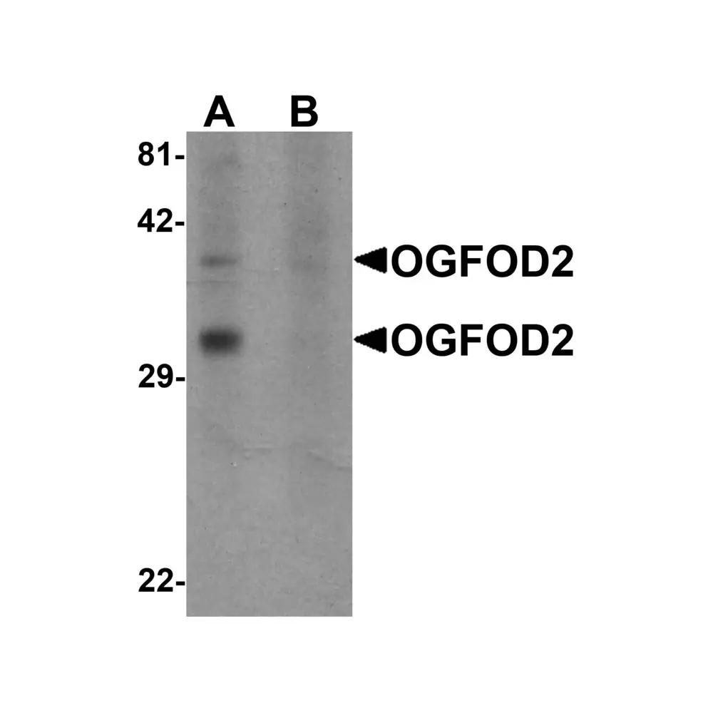 ProSci 6179 OGFOD2 Antibody, ProSci, 0.1 mg/Unit Primary Image