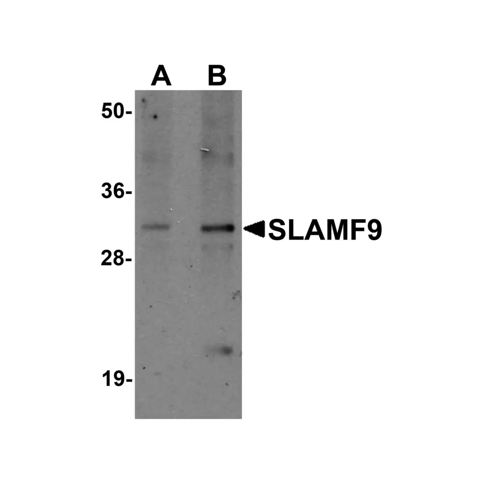 ProSci 6181 SLAMF9 Antibody, ProSci, 0.1 mg/Unit Primary Image