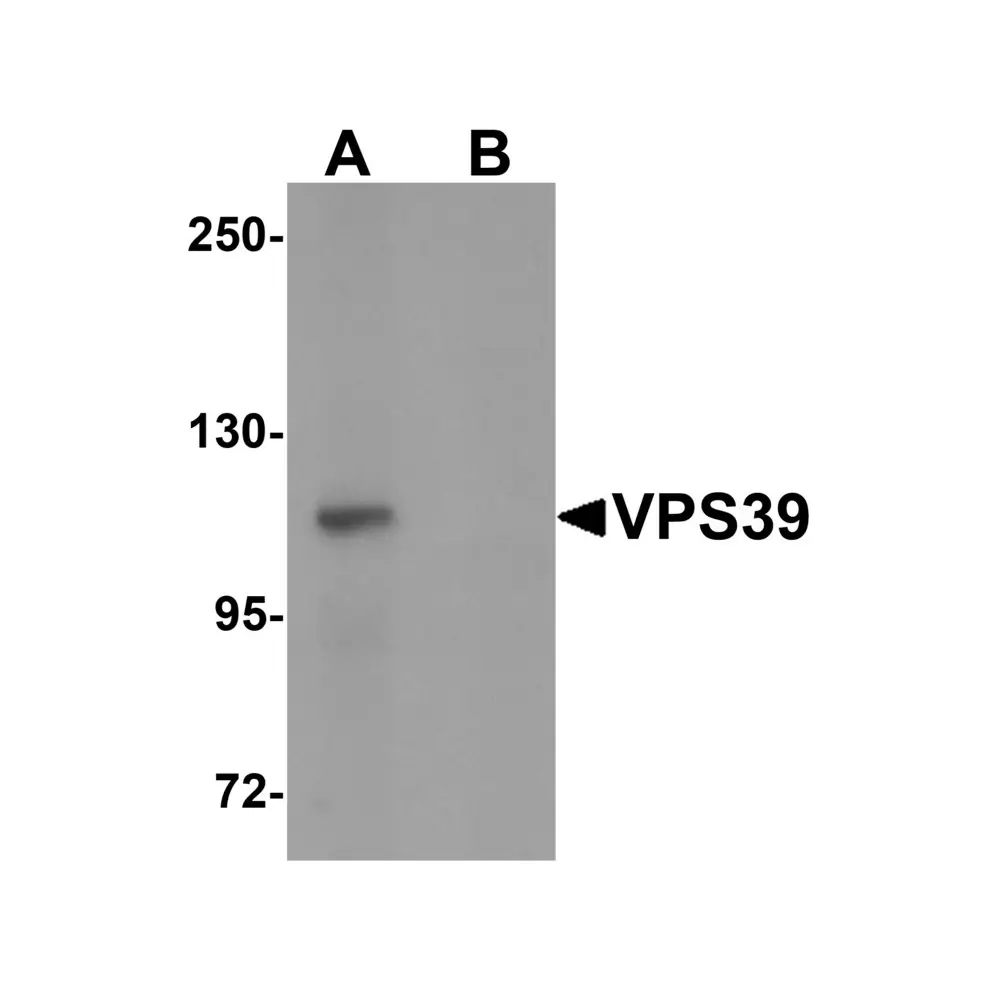ProSci 6183_S VPS39 Antibody, ProSci, 0.02 mg/Unit Primary Image