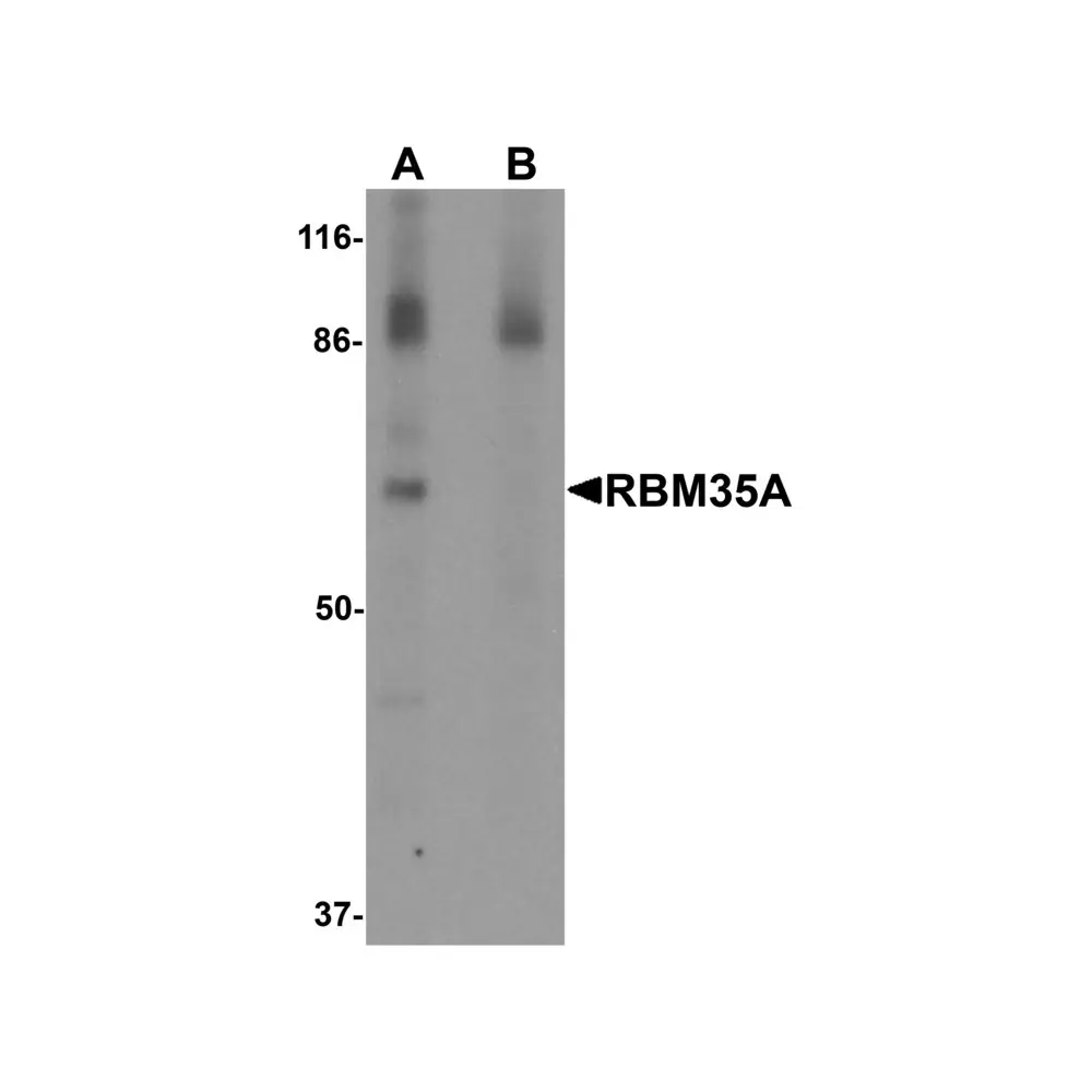ProSci 6185 RBM35A Antibody, ProSci, 0.1 mg/Unit Primary Image