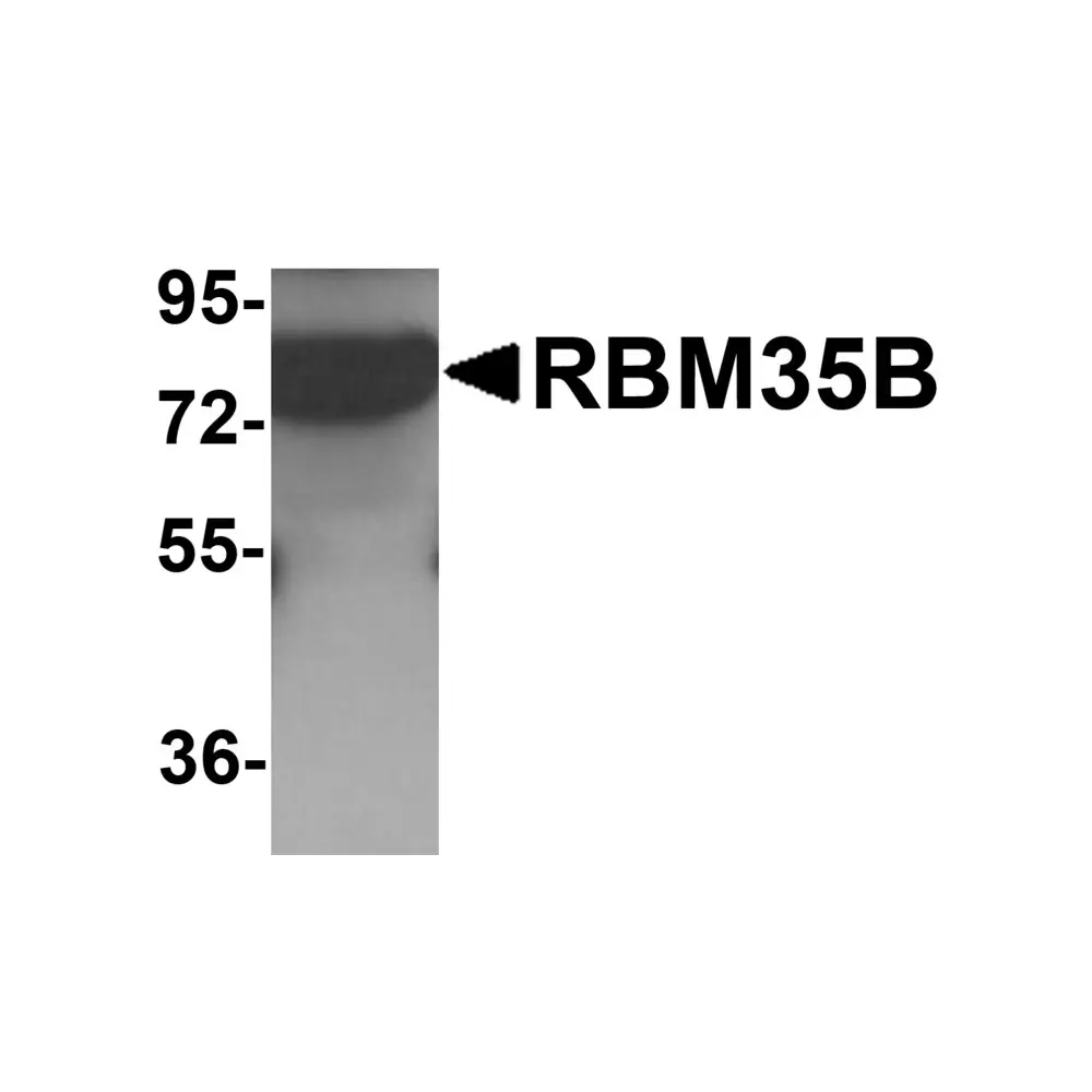ProSci 6187 RBM35B Antibody, ProSci, 0.1 mg/Unit Primary Image