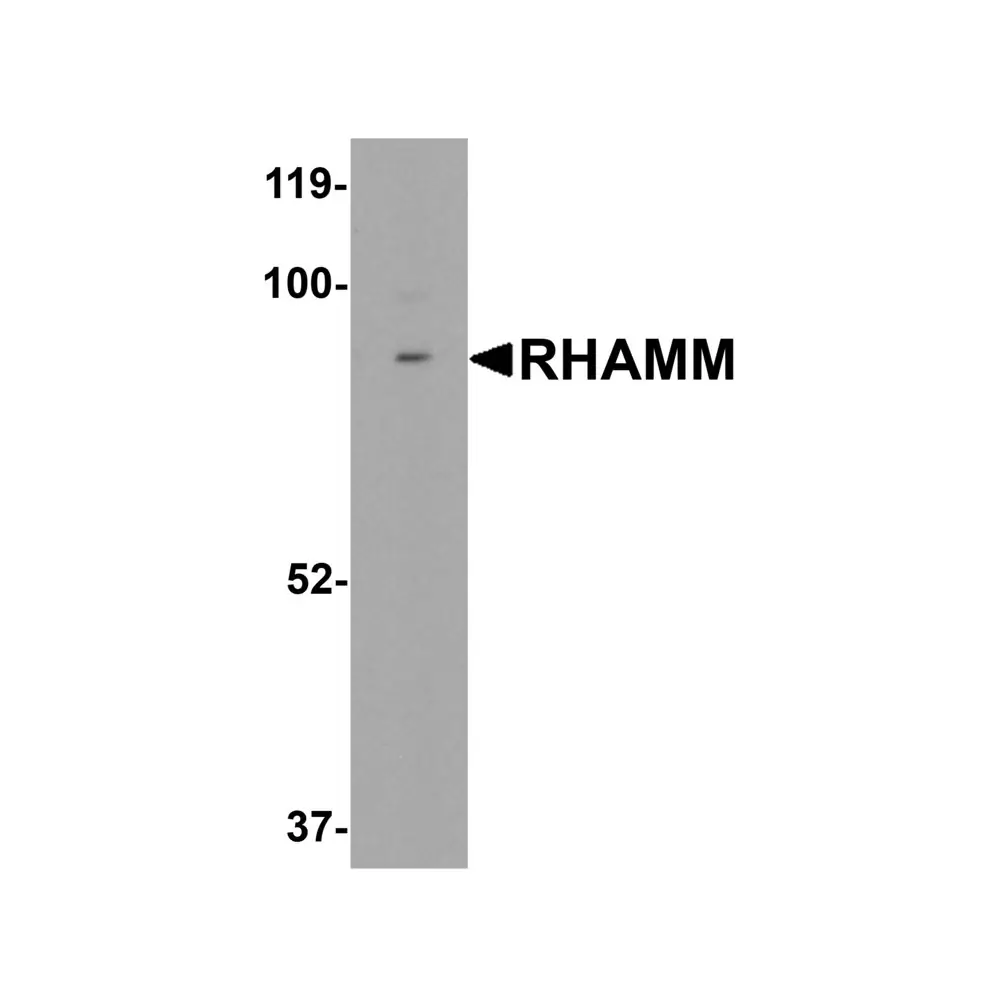 ProSci 6189 RHAMM Antibody, ProSci, 0.1 mg/Unit Primary Image