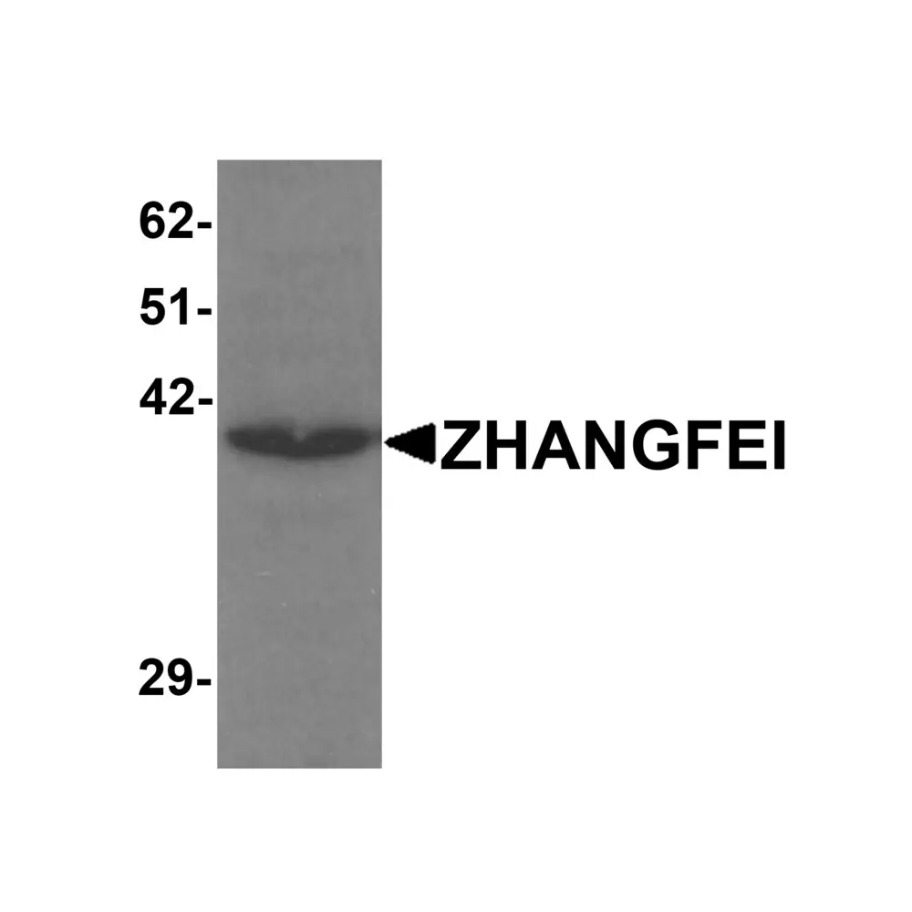 ProSci 6191_S ZHANGFEI Antibody, ProSci, 0.02 mg/Unit Primary Image