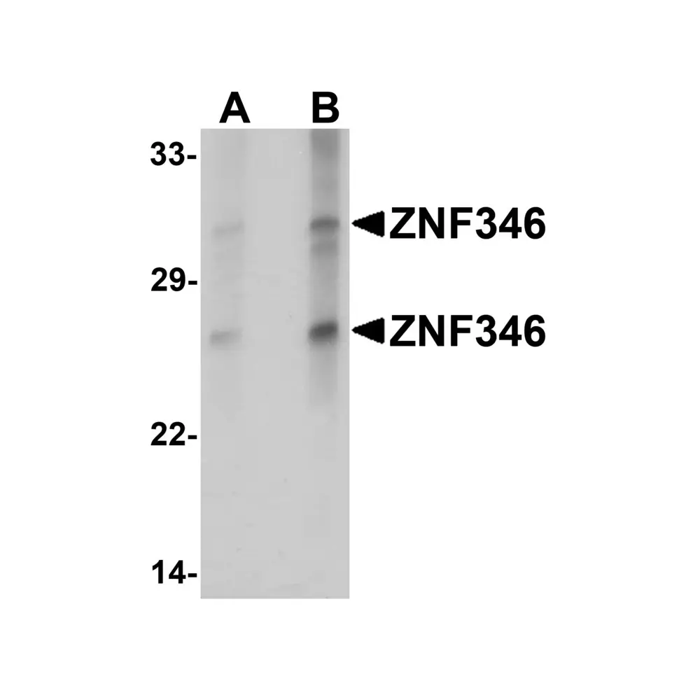ProSci 6209_S ZNF346 (CT) Antibody, ProSci, 0.02 mg/Unit Primary Image