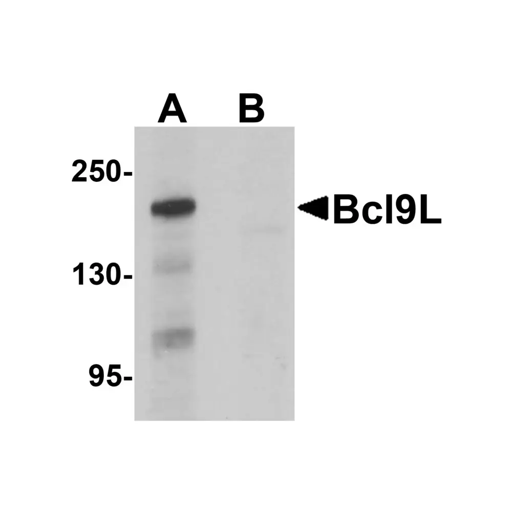 ProSci 6213_S Bcl9L Antibody, ProSci, 0.02 mg/Unit Primary Image