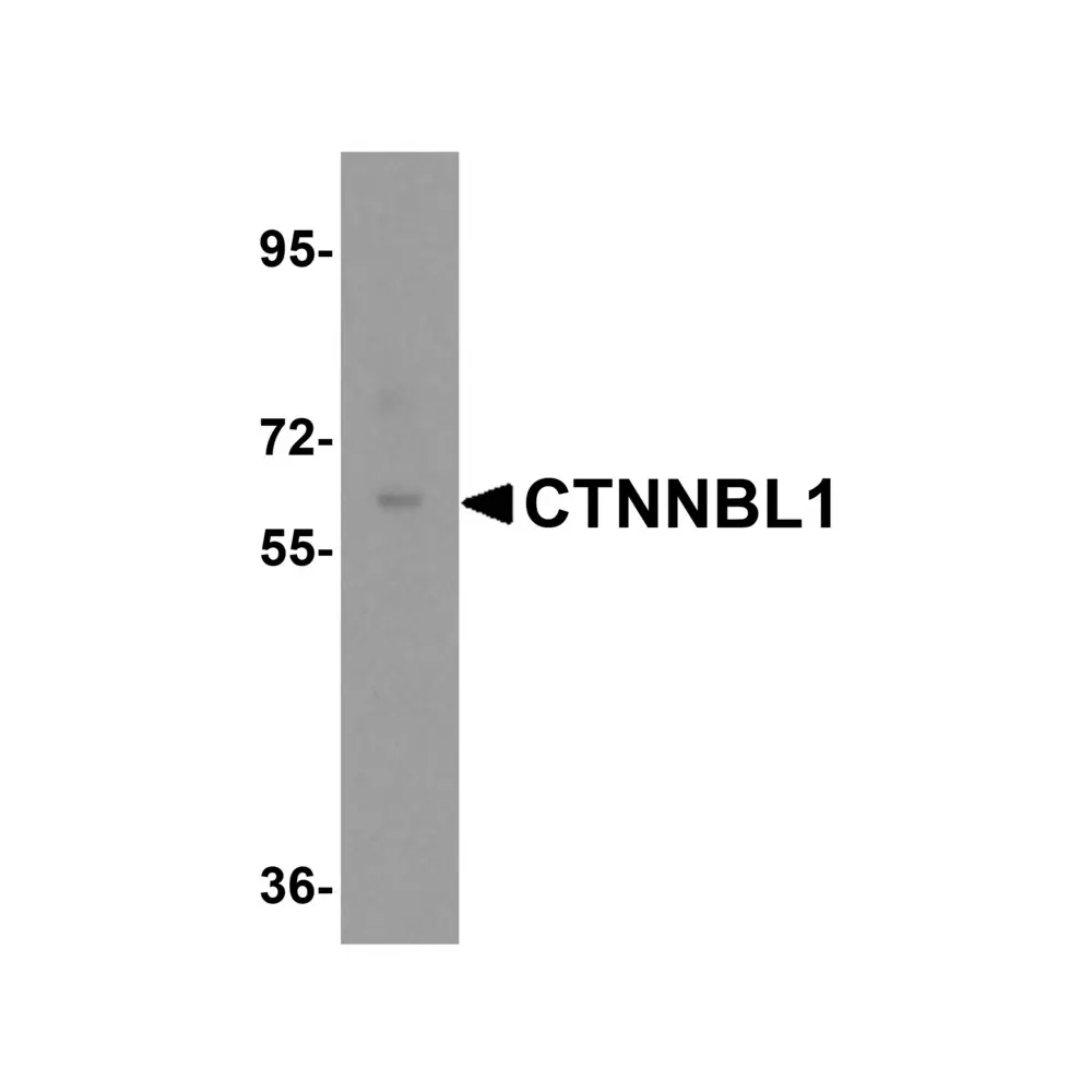 ProSci 6215 CTTNBL1 Antibody, ProSci, 0.1 mg/Unit Primary Image