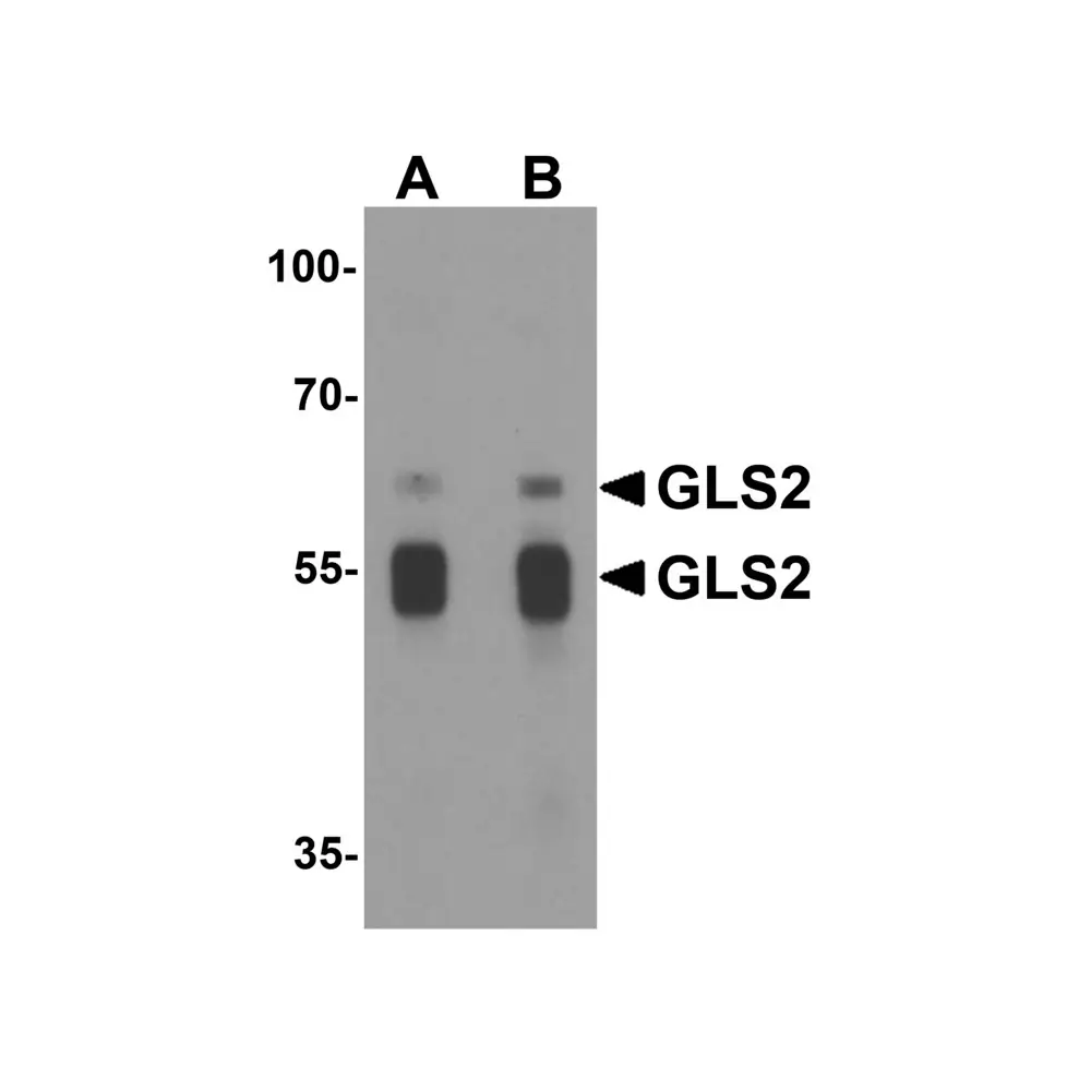 ProSci 6217 GLS2 Antibody, ProSci, 0.1 mg/Unit Primary Image