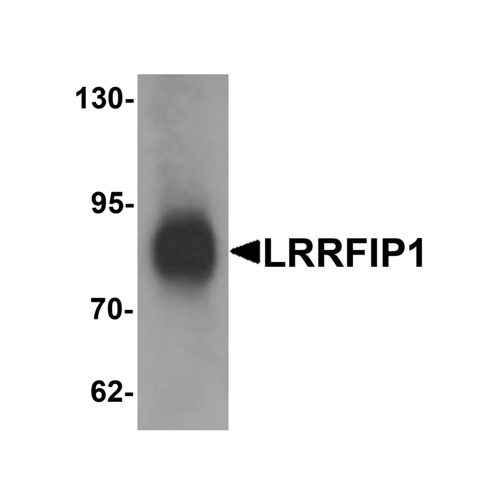 ProSci 6219_S LRRFIP1 Antibody, ProSci, 0.02 mg/Unit Primary Image
