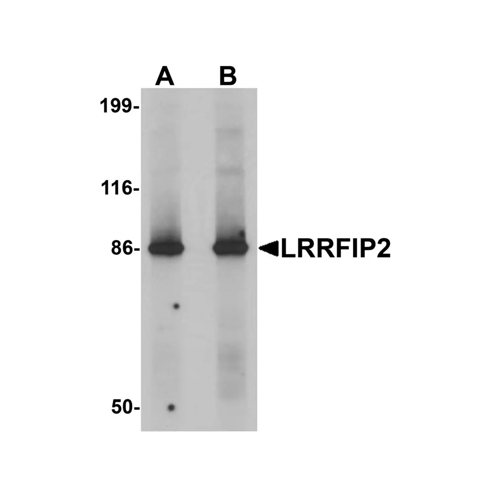 ProSci 6221 LRRFIP2 Antibody, ProSci, 0.1 mg/Unit Primary Image