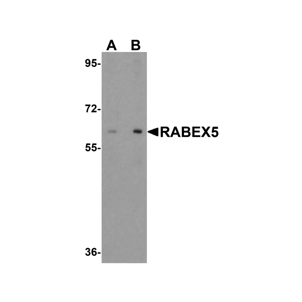 ProSci 6225 RABEX5 Antibody, ProSci, 0.1 mg/Unit Primary Image