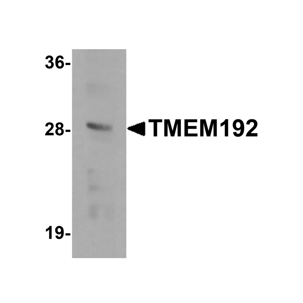 ProSci 6227_S TMEM192 Antibody, ProSci, 0.02 mg/Unit Primary Image
