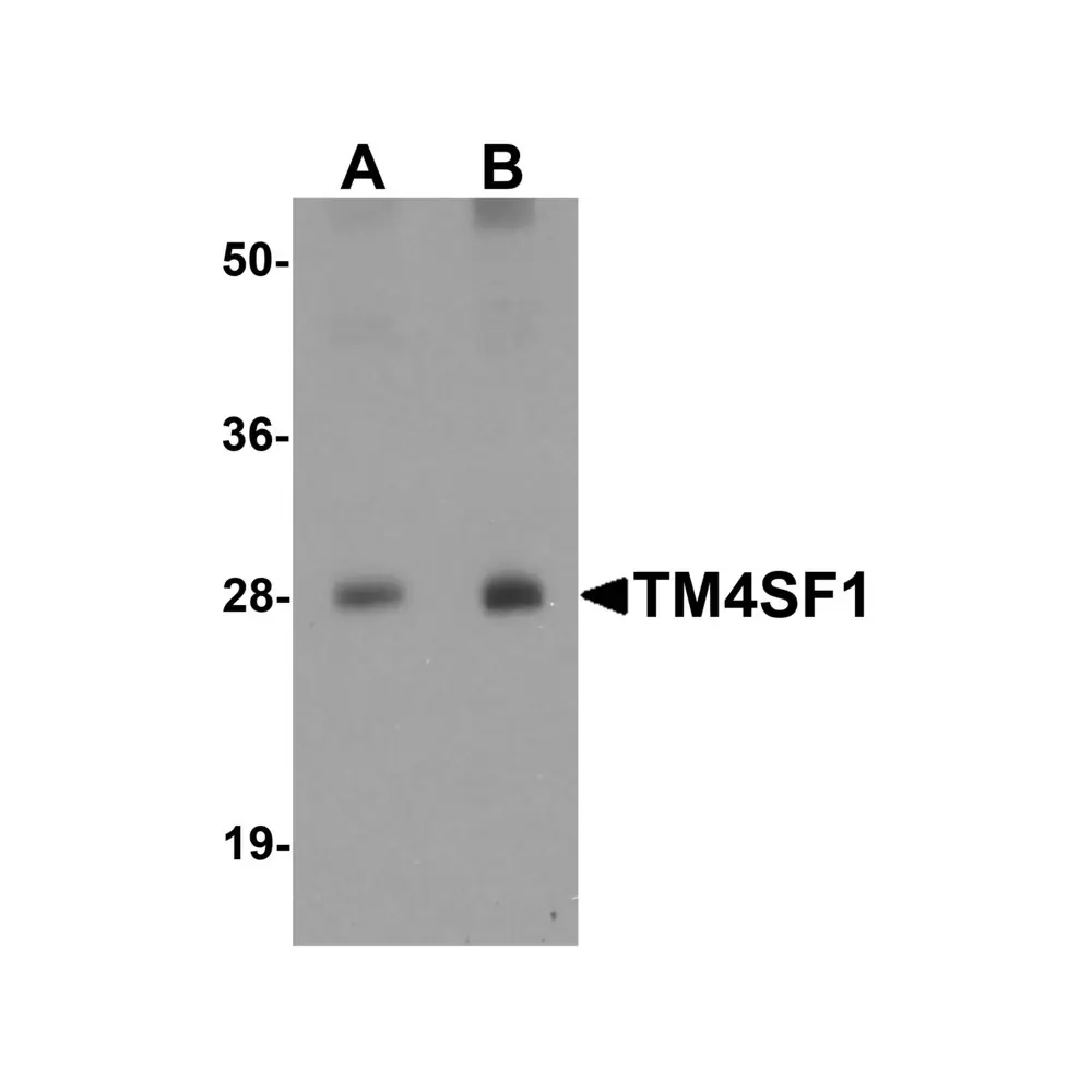 ProSci 6229 TM4SF1 Antibody, ProSci, 0.1 mg/Unit Primary Image