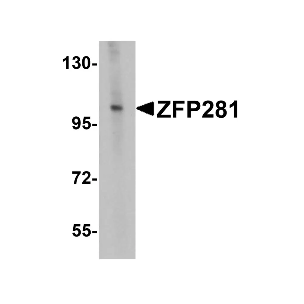 ProSci 6233_S ZFP281 Antibody, ProSci, 0.02 mg/Unit Primary Image