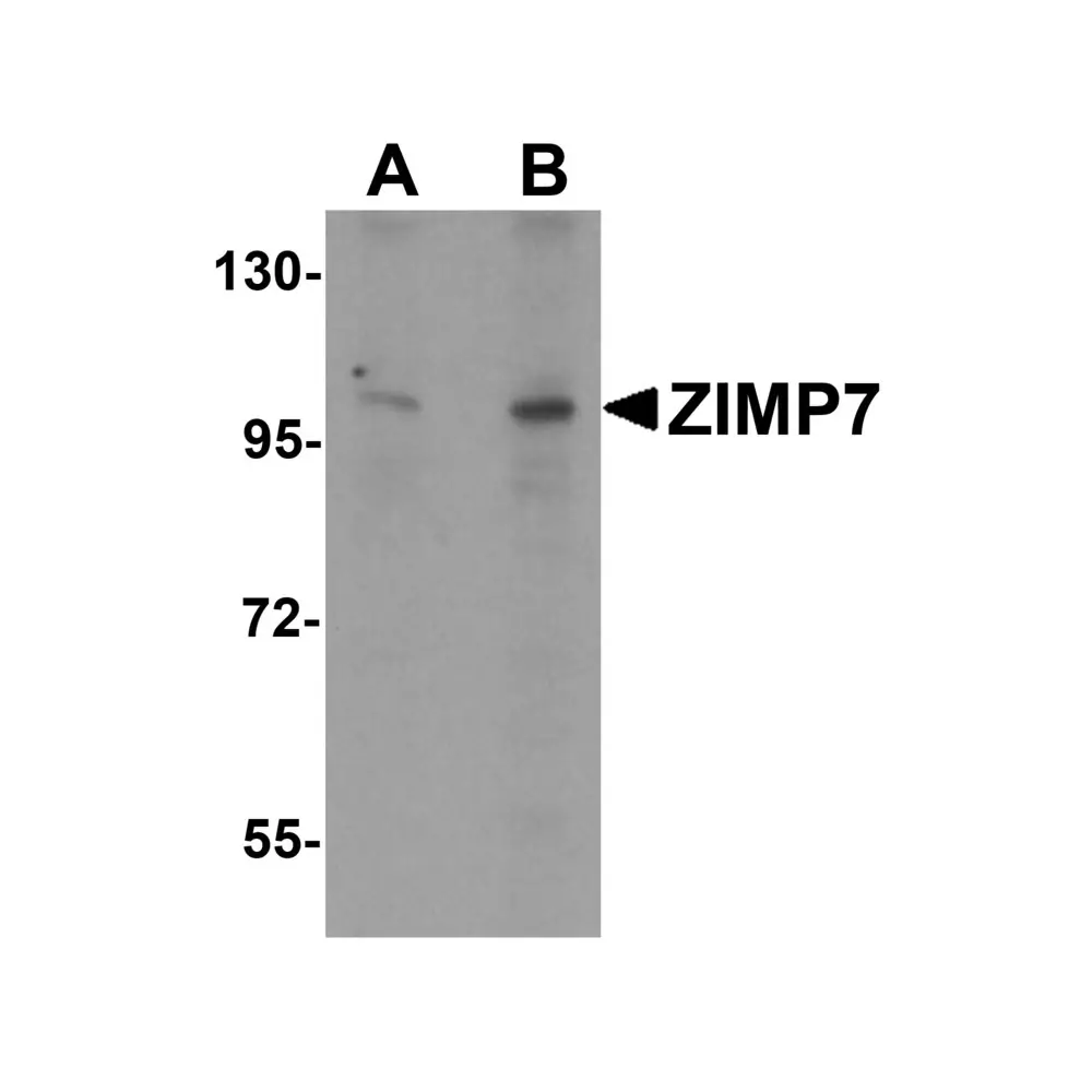 ProSci 6235 ZIMP7 Antibody, ProSci, 0.1 mg/Unit Primary Image